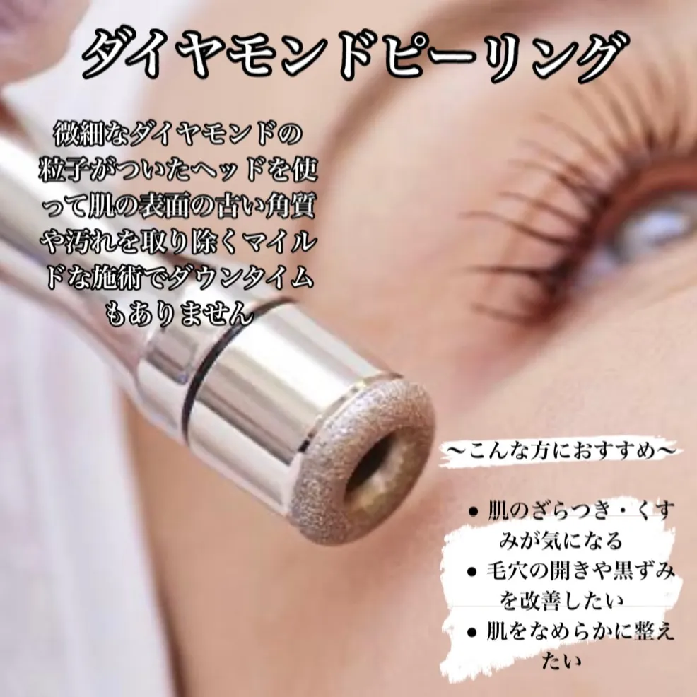 先日嬉しい口コミを頂きました、30代男性の症例のお写真☆