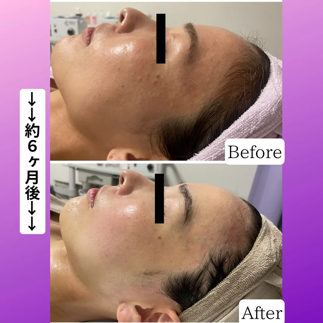 お客様の症例写真をご紹介致します!!