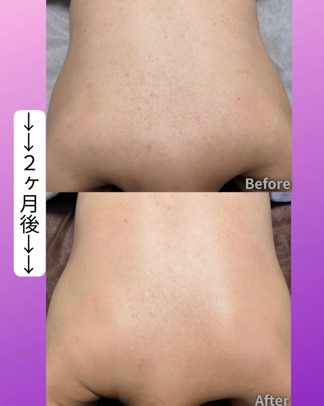 ＼お客様Before→After✨／